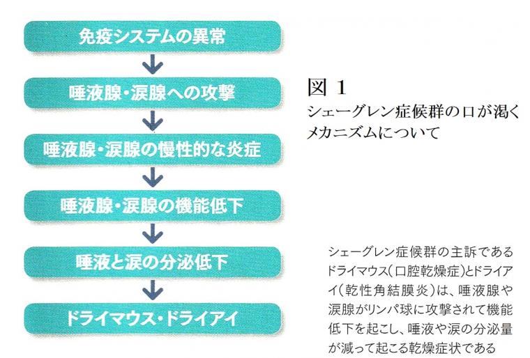 シェーグレン症候群を例に医科と歯科の連携の重要性について