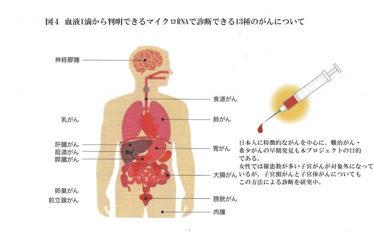 がんの診断に関わる「マイクロRNA」について（前編）