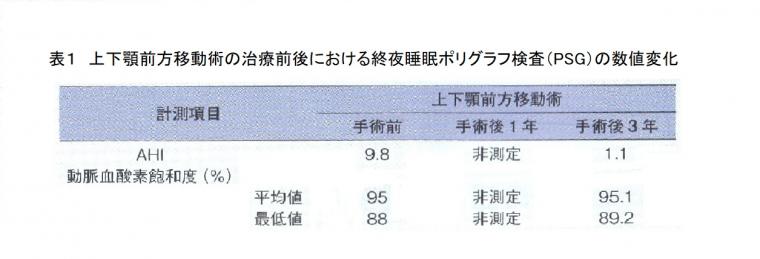 睡眠時無呼吸の一般的な治療法と矯正歯科での治療例について