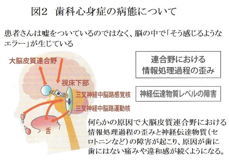 歯科心身症への対応について