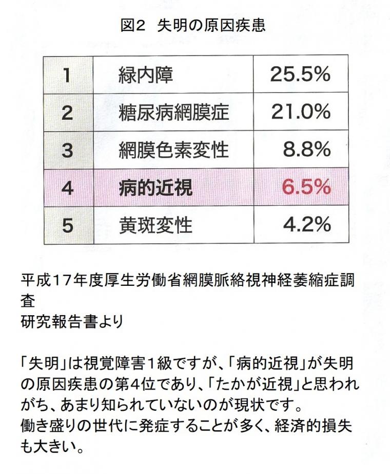 近視がもたらす重大疾患について（前編）