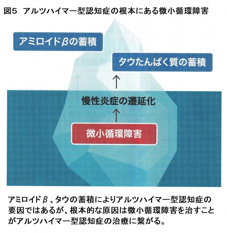 「低出力パルス波超音波治療によるアルツハイマー病への応用について（前編）」