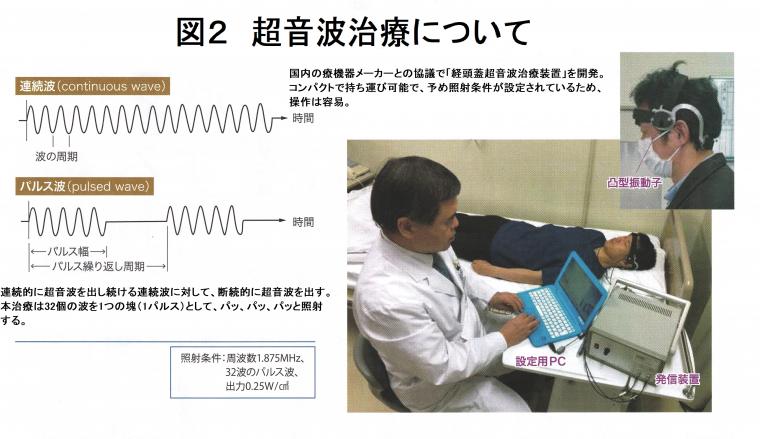 「低出力パルス波超音波治療によるアルツハイマー病への応用について（前編）」