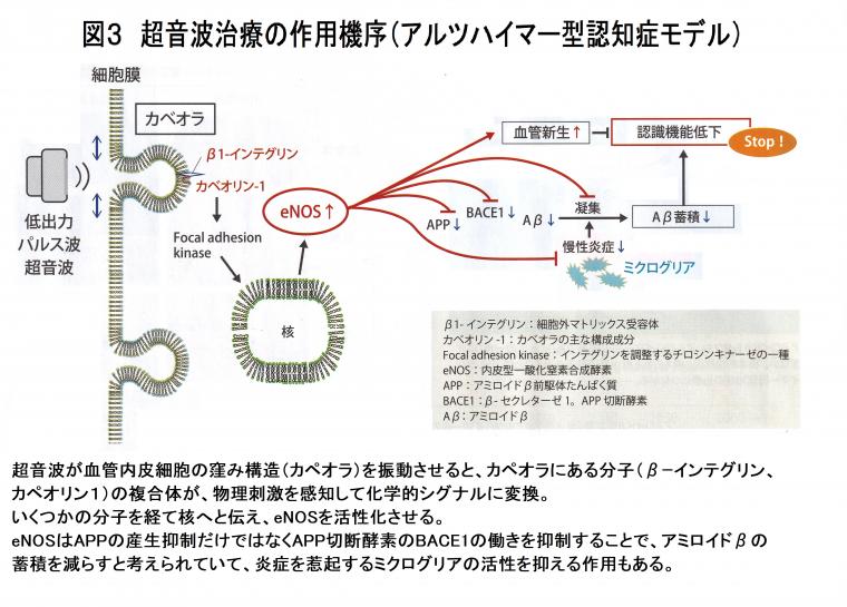 「低出力パルス波超音波治療によるアルツハイマー病への応用について（前編）」