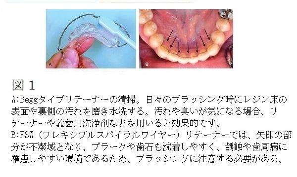 保定期間中の口腔衛生管理について