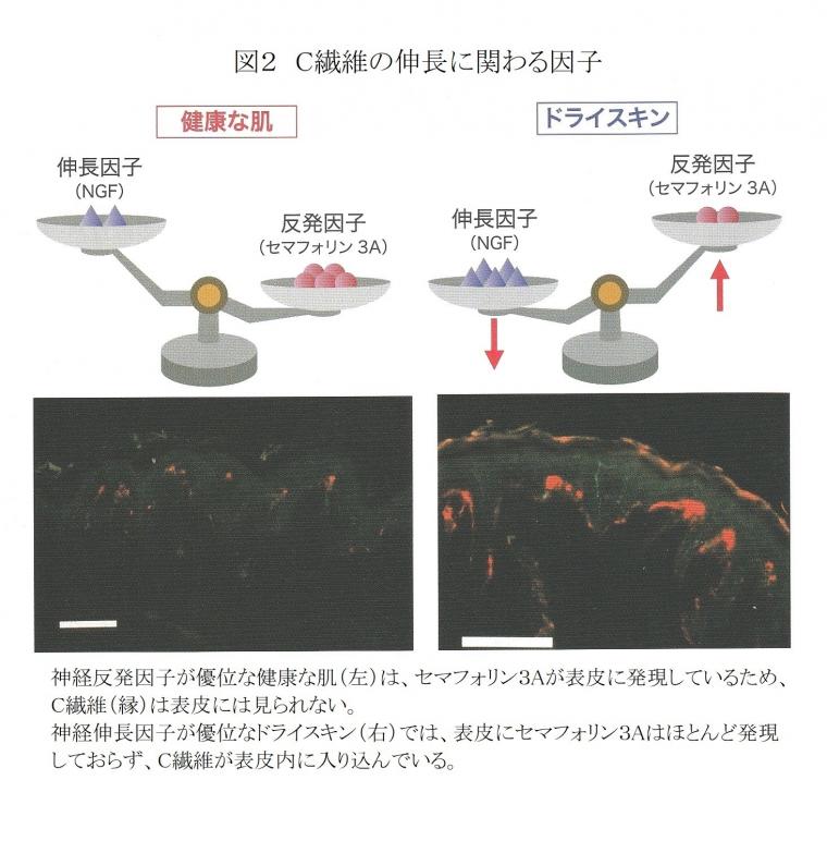 [痒み」について（前編）