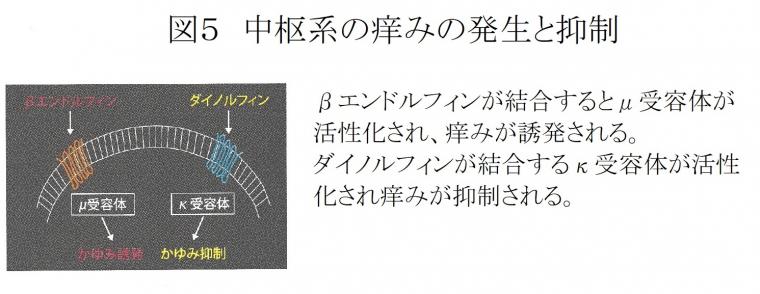 「痒み」について（後編）