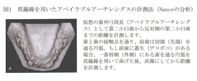 矯正治療でなぜ抜歯が必要なのか