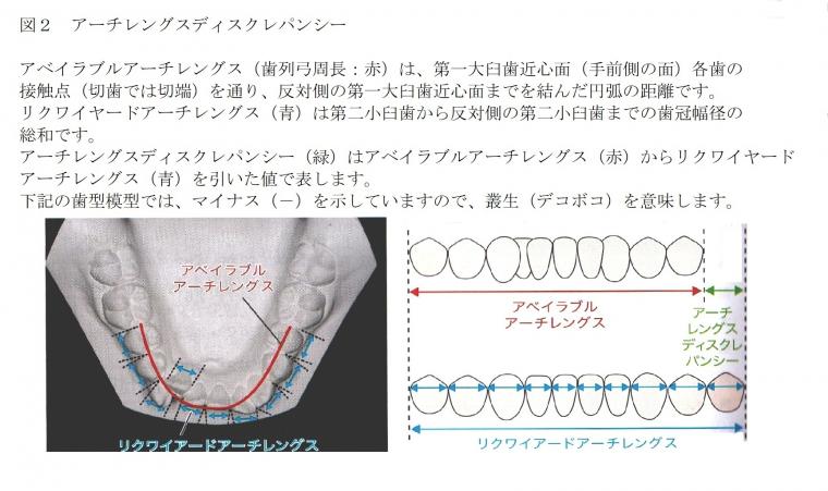 矯正治療でなぜ抜歯が必要なのか