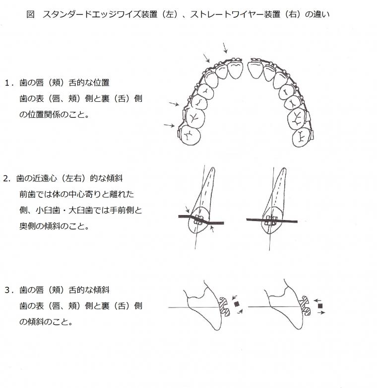 マルチブラケット装置について