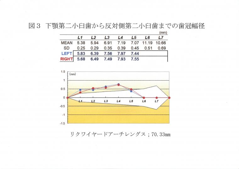 抜歯する?しない?ってどうやって決めているの?