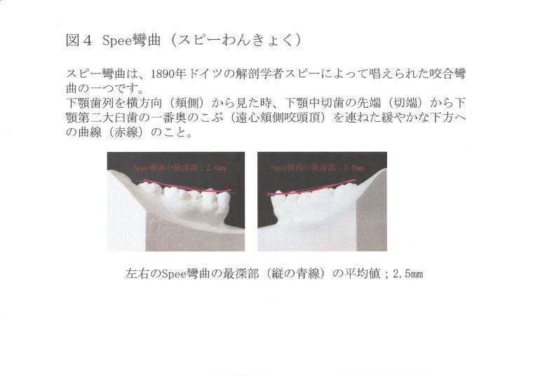 抜歯する?しない?ってどうやって決めているの?