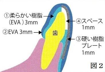 スポーツ歯科における歯科医師の役割とマウスガードによる支援について