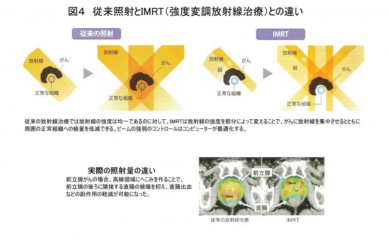 最新がん放射線治療について（前編）