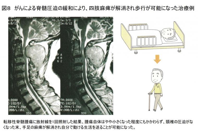 最新がん放射線治療について（後編）