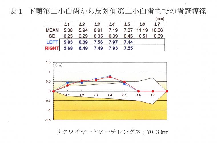 抜歯する？しない？ってどうやって決めているの？