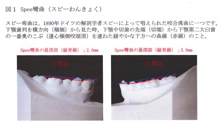 抜歯する？しない？ってどうやって決めているの？