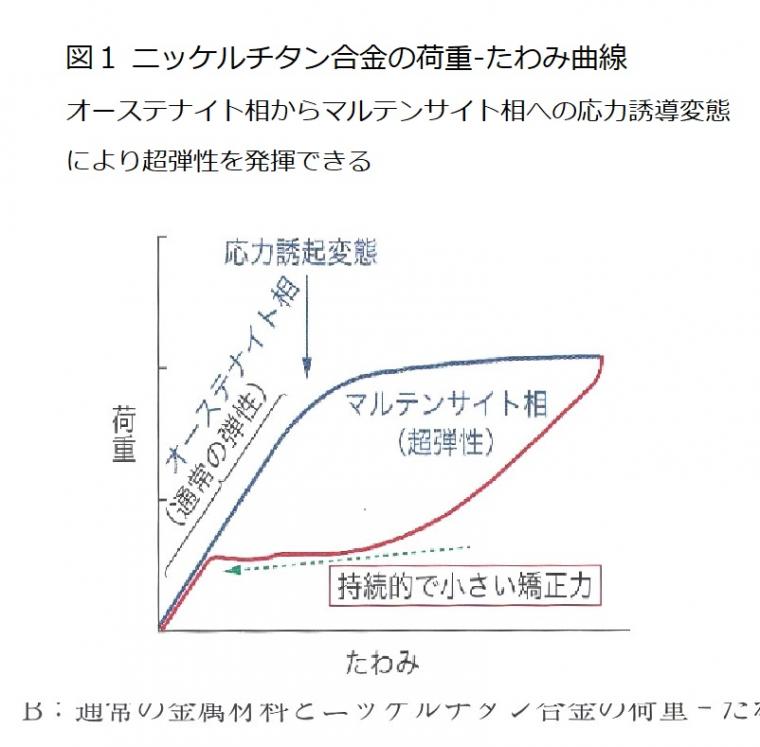 矯正用ワイヤーの材質の違いによる特性について
