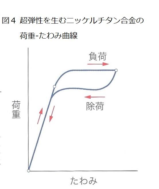 矯正用ワイヤーの材質の違いによる特性について