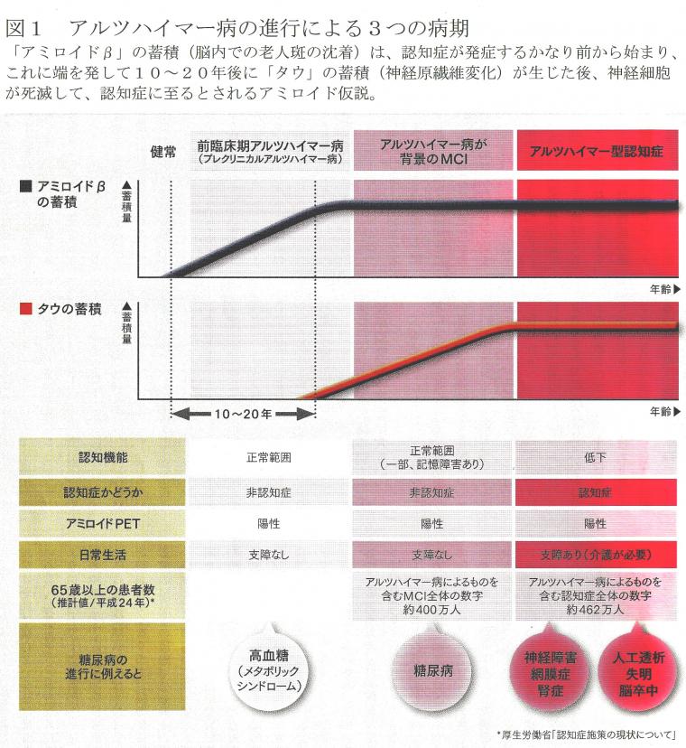 「アルツハイマー型認知症の超早期発見」の重要性（前編）について