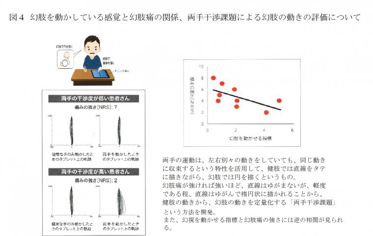 「幻肢痛」の治療に活用されるVRについて（前編）