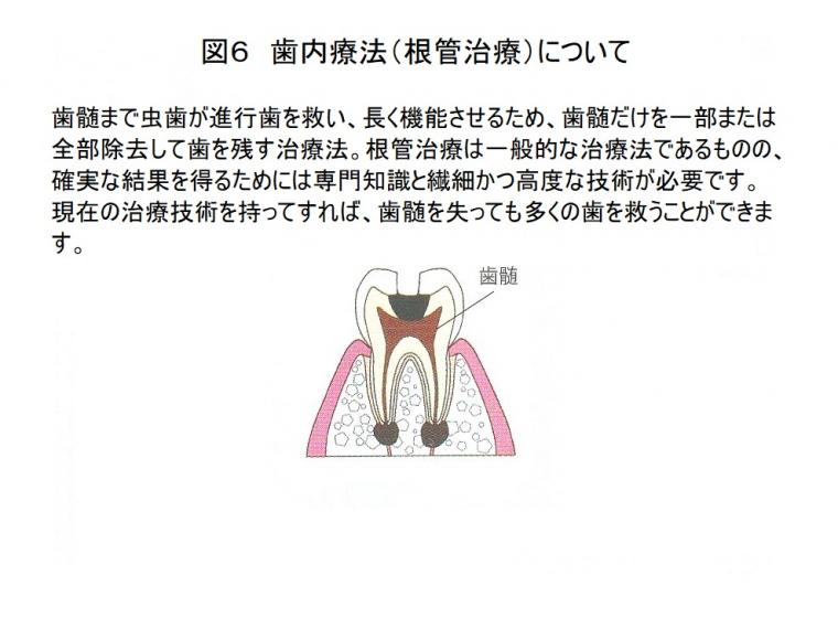 ミドル世代の虫歯の実態について