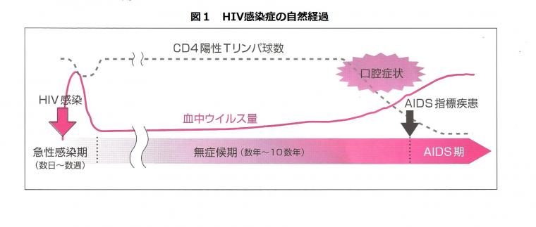 HIV感染者に対する歯科治療について