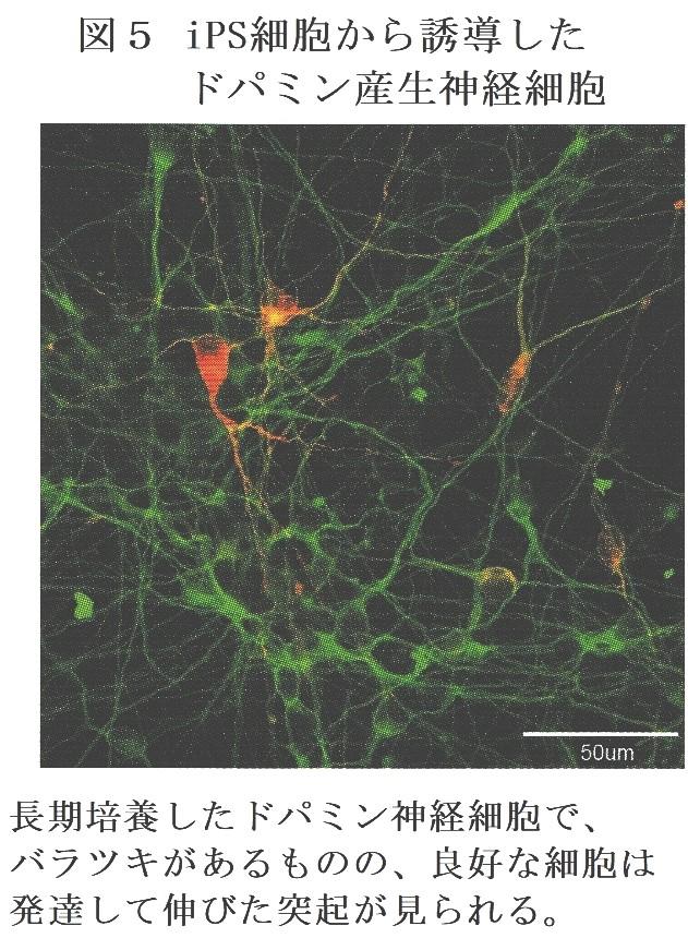 iPS細胞を利用したパーキンソン病の治験について（前編）