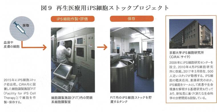 iPS細胞を利用したパーキンソン病の治験について（後編）